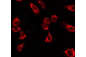 Immunofluorescence (fixed cells) (IF/ICC) image for anti-Keratin 18 (KRT18) (C-Term) antibody (ABIN6262779)