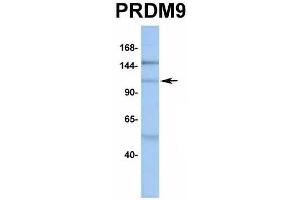 Host:  Rabbit  Target Name:  PRDM9  Sample Type:  MCF7  Antibody Dilution:  1. (PRDM9 antibody  (Middle Region))