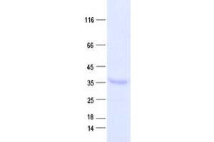 Validation with Western Blot (DUS4L Protein (His tag))