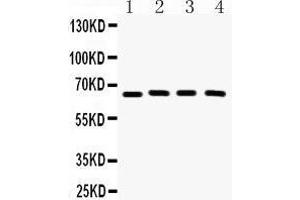 Western Blotting (WB) image for anti-Cryptochrome 2 (Photolyase-Like) (CRY2) (AA 171-200), (N-Term) antibody (ABIN3042760) (CRY2 antibody  (N-Term))