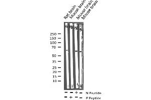 Western blot analysis of Phospho-Elk1 (Ser389) expression in various lysates (ELK1 antibody  (pSer389))