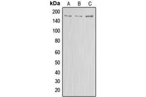 Western blot analysis of ABCA8 expression in HEK293T (A), Raw264.