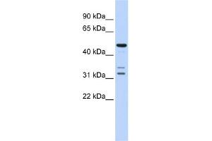 WB Suggested Anti-HTRA4 Antibody Titration: 0. (HTRA4 antibody  (Middle Region))