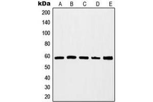 Western blot analysis of c-Myc expression in HEK293A (A), Jurkat (B), K562 (C), HeLa (D), NIH3T3 (E) whole cell lysates. (c-MYC antibody  (C-Term))