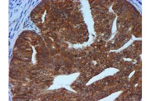 Image no. 3 for anti-Metalloproteinase Inhibitor 2 (TIMP2) antibody (ABIN1501393)