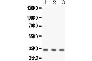 Anti-Calponin antibody,Western blotting All lanes: Anti -Calponin  at 0. (CNN1 antibody  (C-Term))