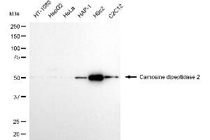 Western blotting analysis using carnosine dipeptidase 2 antibody (ABIN7798103).