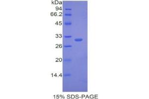 SDS-PAGE analysis of Mouse ATP1b1 Protein. (ATPase, Na+/K+ Transporting, beta 1 Polypeptide (ATP1B1) Peptide)