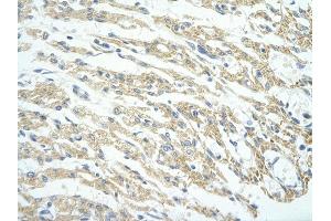 Rabbit Anti-PHF11 antibody         Paraffin Embedded Tissue:  Human Heart    cell Cellular Data:  cardiac cell    Antibody Concentration:  4. (PHF11 antibody  (Middle Region))