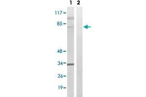 Western blot analysis of Lane 1: Untreated HeLa cell lysates, Lane 2: Synthesized peptide treated HeLa cell lysates reacted with MDM4 (phospho S367) polyclonal antibody  at 1:500-1:3000 dilution.