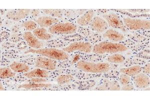 ABIN870670 (2µg/ml) staining of paraffin embedded Human Kidney. (NPR3 antibody  (AA 520-533))
