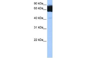 WB Suggested Anti-TTC12 Antibody Titration: 0. (TTC12 antibody  (C-Term))