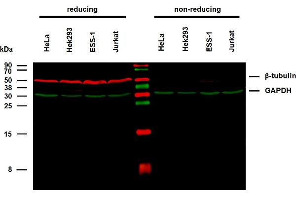 TUBB antibody