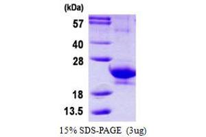 Image no. 1 for Interferon, alpha 14 (IFNa14) protein (His tag) (ABIN1098610) (IFNa14 Protein (His tag))