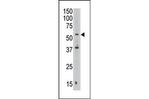 The anti-SEPT9 Pab (ABIN390155 and ABIN2840654) is used in Western blot to detect SEPT9 in Jurkat cell lysate. (Septin 9 antibody  (C-Term))