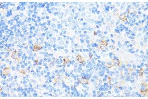 Immunohistochemistry of paraffin-embedded Rat spleen using CD11A Polyclonal Antibody at dilution of 1:100 (40x lens). (ITGAL antibody)