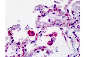 Human Lung: Formalin-Fixed, Paraffin-Embedded (FFPE) (SMO antibody  (N-Term))