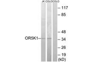 Western blot analysis of extracts from COLO/Jurkat cells, using OR5K1 Antibody.