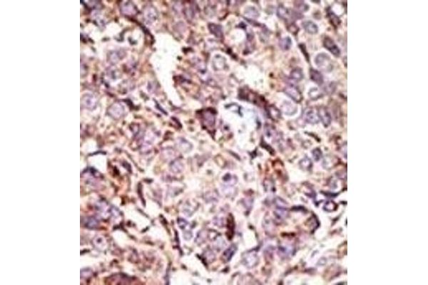 ARL6 antibody  (N-Term)