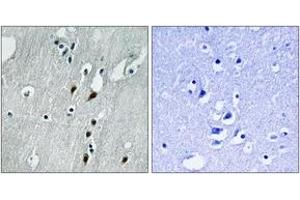 Immunohistochemistry (IHC) image for anti-Programmed Cell Death 4 (PDCD4) (AA 420-469), (pSer457) antibody (ABIN1531725)