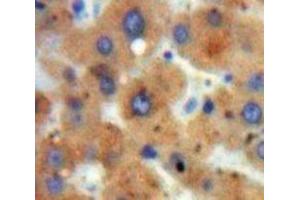 Used in DAB staining on fromalin fixed paraffin-embedded Liver tissue (HDAC6 antibody  (AA 1038-1204))