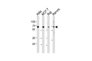 Western Blotting (WB) image for anti-Nuclear Factor-kB p65 (NFkBP65) (AA 10-37), (N-Term) antibody (ABIN1882124)