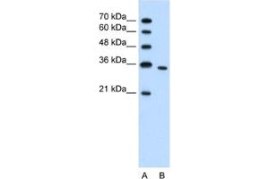 Western Blotting (WB) image for anti-phosphoribosyl Pyrophosphate Synthetase 2 (PRPS2) antibody (ABIN2462424) (PRPS2 antibody)
