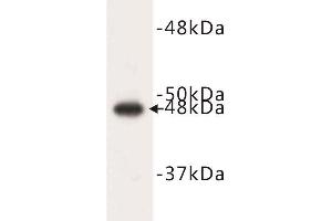Western Blotting (WB) image for anti-Keratin 17 (KRT17) (N-Term) antibody (ABIN1854878) (KRT17 antibody  (N-Term))