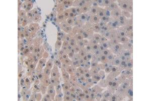 Used in DAB staining on fromalin fixed paraffin- embedded Kidney tissue (BCOR antibody  (AA 1553-1755))