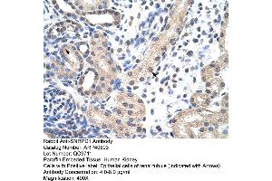 SNRPD1 antibody  (N-Term)