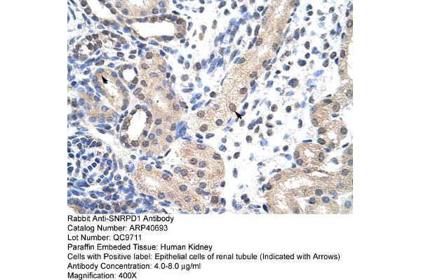 SNRPD1 antibody  (N-Term)