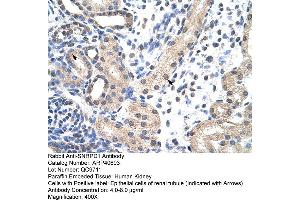 Rabbit Anti-SNRPD1 Antibody  Paraffin Embedded Tissue: Human Kidney Cellular Data: Epithelial cells of renal tubule Antibody Concentration: 4. (SNRPD1 antibody  (N-Term))