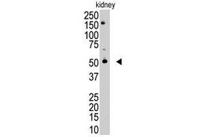 The RNF216 polyclonal antibody  is used in Western blot to detect RNF216 in mouse kidney tissue lysate.