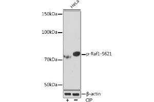 Western blot analysis of extracts of HeLa cells, using Phospho-Raf1-S621 Rabbit mAb (ABIN7271267) at 1:1000 dilution. (RAF1 antibody  (pSer621))