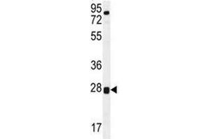 TOR2A antibody western blot analysis in human placenta tissue lysate. (TOR2A antibody  (AA 194-221))