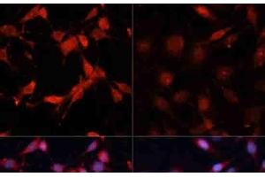 Immunofluorescence analysis of C6 cells using Phospho-P70 S6K(T389) Polyclonal Antibody at dilution of 1:100. (RPS6KB1 antibody  (pThr389))