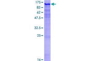 MAST2 Protein (AA 1-792) (GST tag)