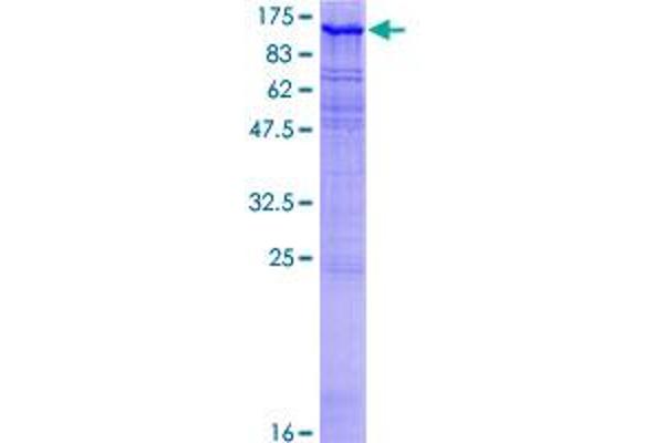 MAST2 Protein (AA 1-792) (GST tag)