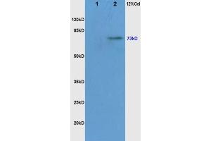 Lane 1: Mouse Liver, lysates Lane 2: Mouse Brain probed with Rabbit Anti-c-Raf(Ser338/Tyr340) Polyclonal Antibody, Unconjugated  at 1:200 overnight at 4˚C. (RAF1 antibody  (pSer338, pTyr340))