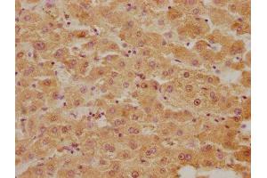 IHC image of ABIN7152961 diluted at 1:300 and staining in paraffin-embedded human liver tissue performed on a Leica BondTM system. (BLVRB antibody  (AA 2-206))