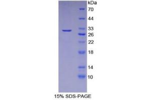 SDS-PAGE (SDS) image for DNA Fragmentation Factor, 40kDa, beta Polypeptide (Caspase-Activated DNase) (DFFB) (AA 87-323) protein (His tag) (ABIN1879297)