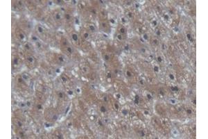 Immunohistochemistry (IHC) image for anti-Pro-Brain Natriuretic Peptide (NT-ProBNP) (NT-ProBNP) (AA 27-102) antibody (ABIN7439867)