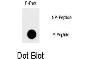 Dot blot analysis of MYC (phospho T58) polyclonal antibody  on nitrocellulose membrane. (c-MYC antibody  (pThr58))