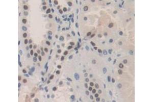 IHC-P analysis of Human Tissue, with DAB staining. (Polybromo 1 antibody  (AA 1-306))
