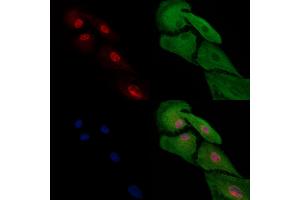 ABIN7094707 and ABIN7098758 staining  cells by IF/ICC. (HAND2 antibody  (Internal Region))