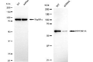 anti-Protein Phosphatase 2, Regulatory Subunit A, beta (PPP2R1B) antibody