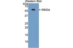 Western blot analysis of the recombinant protein. (CD46 antibody  (AA 157-365))