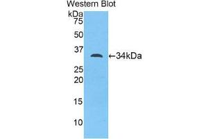 Western Blotting (WB) image for anti-Myosin ID (MYO1D) (AA 581-847) antibody (ABIN1078392) (Myosin ID antibody  (AA 581-847))