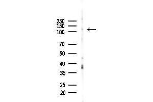 anti-MCF.2 Cell Line Derived Transforming Sequence-Like (MCF2L) (Internal Region) antibody