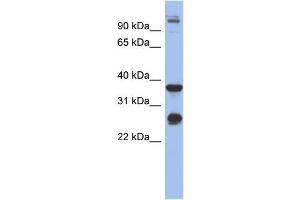 WB Suggested Anti-BGN Antibody Titration: 0. (Biglycan antibody  (Middle Region))